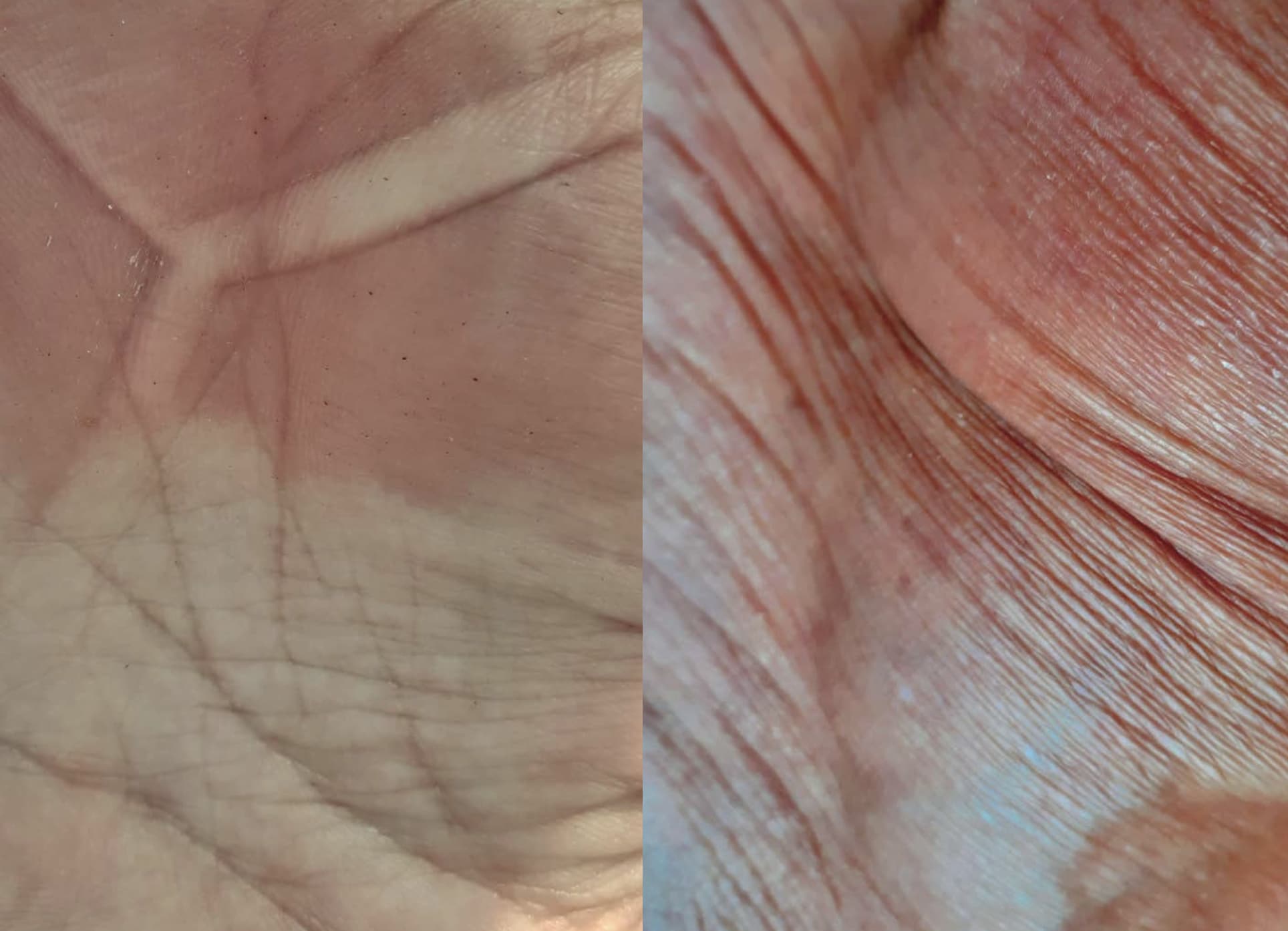 Enzyme #2 - Cos Ahmet